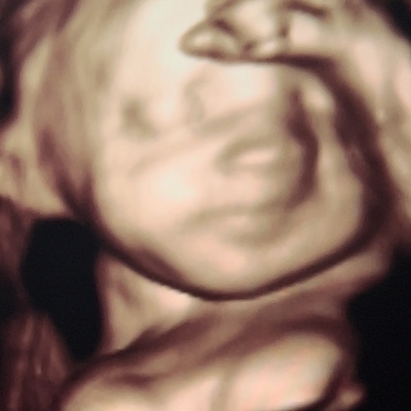 Meet your Posher, Bobbie - Picture 3 of 3